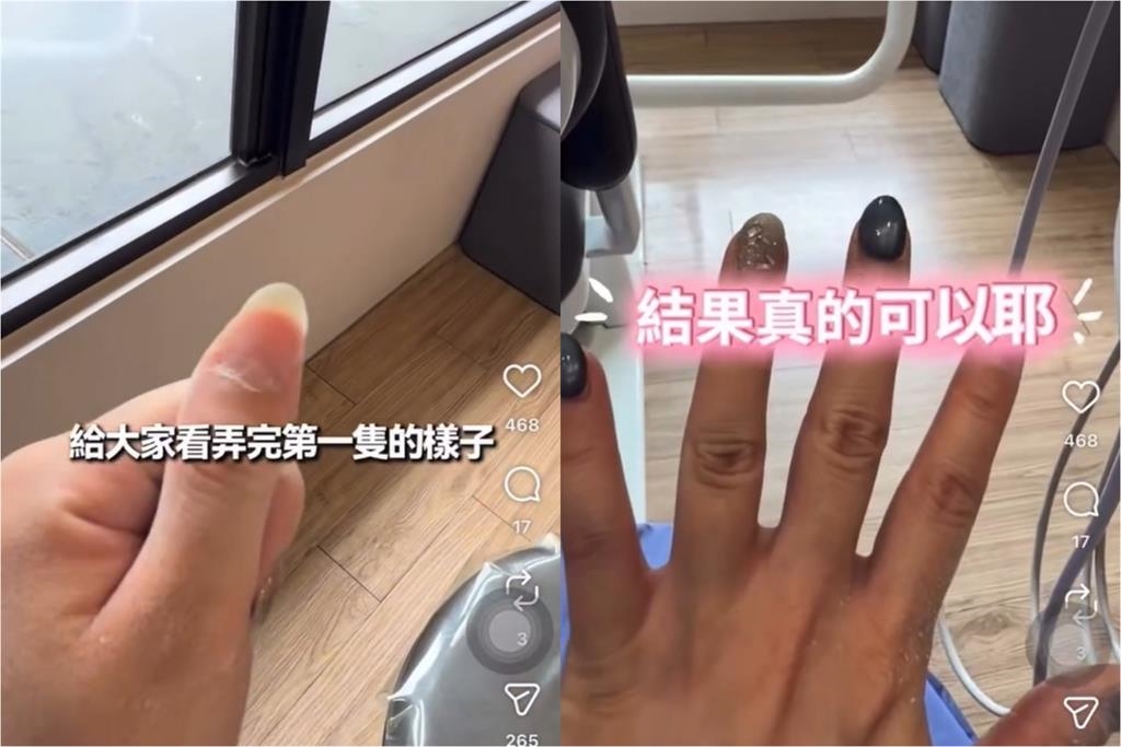 女牙醫私用診所「磨牙機卸美甲」！網怒轟「書讀到哪去」北市衛生局要查了