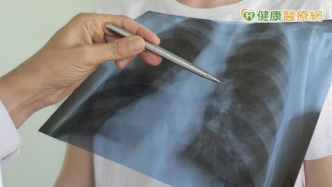 肺癌早期真的沒感覺!72歲翁因跌倒做檢查 意外揪出第一期肺癌