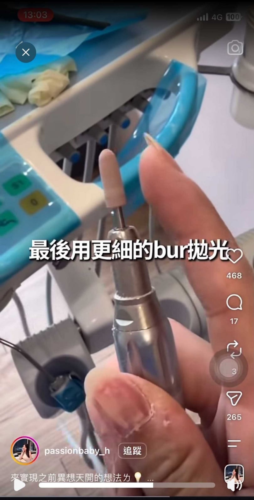 有網友質疑女牙醫拿的bur很新,不太可能卸甲後直接丟棄。(圖/翻攝IG/@passionbaby_h)