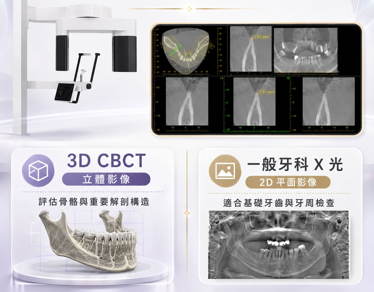植牙前為何要拍3D影像？骨量、神經與植體位置一次掌握 &nbsp; 6