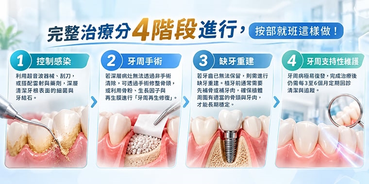 ▲張豪傑醫師強調,完整治療分4階段進行。(圖/AI生成示意圖)