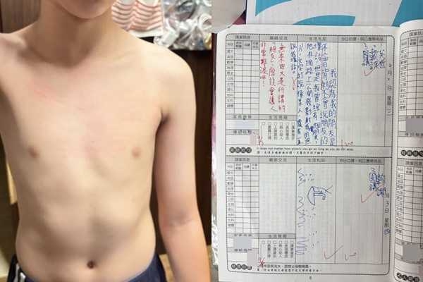 &nbsp;A生曾在聯絡簿向老師反應被欺負，A生家長表示，同學揮刀衝突當天孩子胸口出現明顯抓傷。（圖／民眾提供）