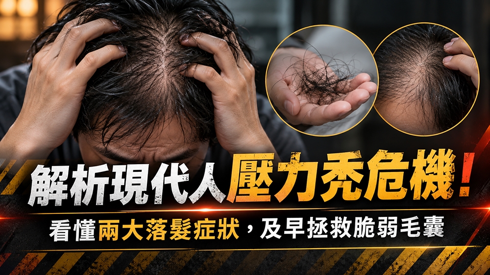 解析現代人壓力與落髮!看懂兩類常見落髮表現與就醫時機