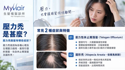 解析現代人壓力與落髮!看懂兩類常見落髮表現與就醫時機