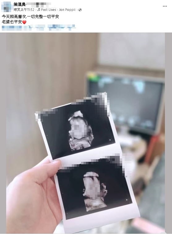 大震撼!陳漢典突宣布「老婆懷孕了」超音波照曝光…5萬人驚喊:不管是誰都恭喜
