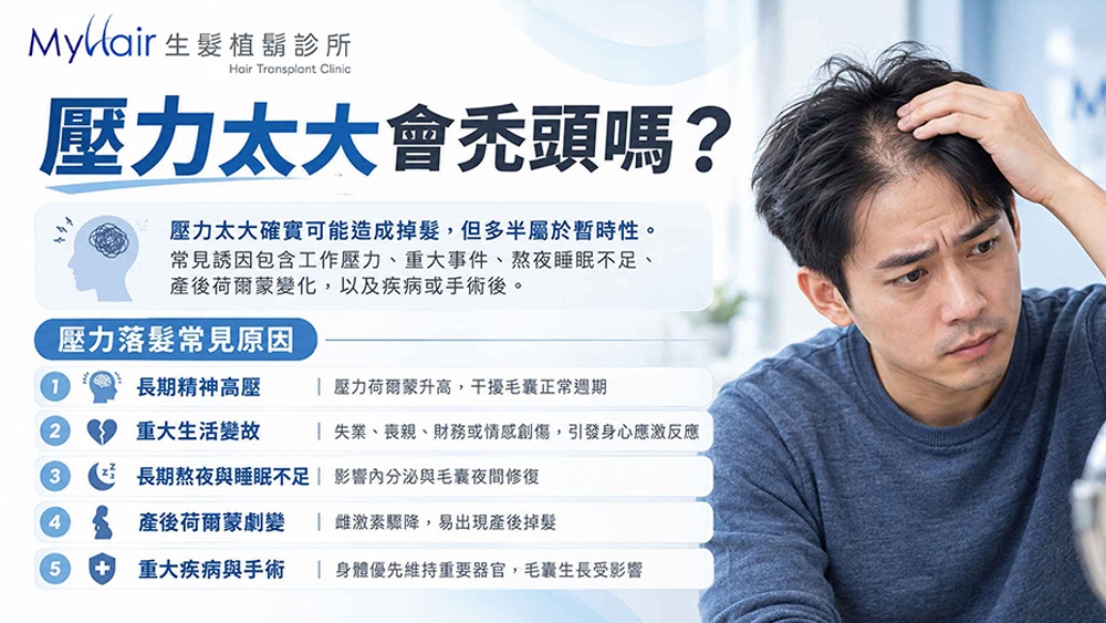 圖說:MyHair生髮植鬍診所-陳煜勛醫師: 壓力太大會禿頭嗎?壓力落髮的常見原因有哪些?