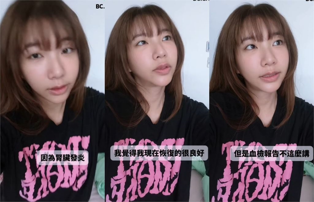 台灣第一女優突掛急診！緊急住院「腎臟出事」素顏揭病況：血檢報告不這麼講…