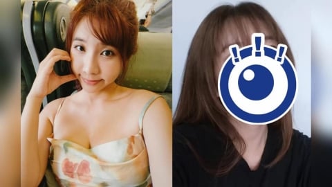 台灣第一女優突掛急診!緊急住院「腎臟出事」素顏揭病況:血檢報告不這麼講…