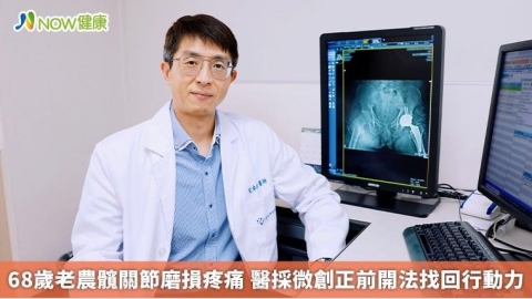 68歲老農髖關節磨損疼痛 醫採微創正前開法找回行動力