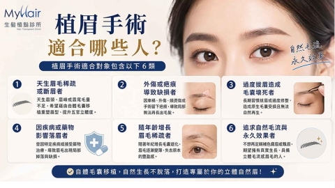 植眉適合哪些人?認識六大常見評估族群與自體毛囊移植注意事項