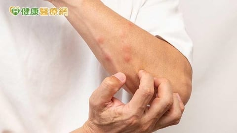 換季皮膚乾癢怎麼辦?醫揭常見原因 保濕、洗澡習慣是關鍵