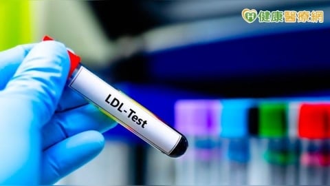 膽固醇沒紅字也會中風！降脂多元治療　健保給付放寬