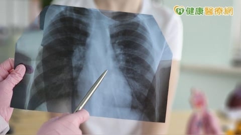 晚期EGFR突變型肺癌治療怎麼選?醫:大型臨床證據、治療指引是重要參考