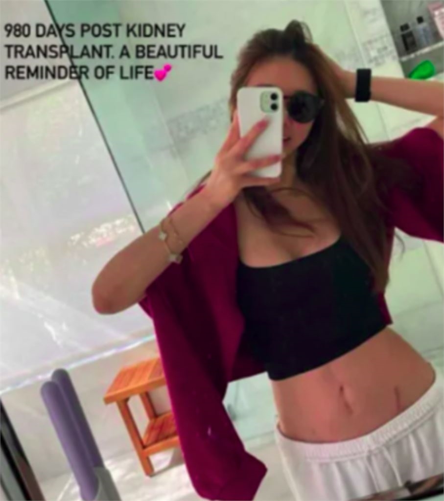 孫芸芸49歲親姊「腎臟移植980天」認了!社群突PO照「傷疤」不藏了