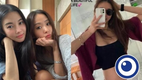 孫芸芸49歲親姊「腎臟移植980天」認了!社群突PO照「傷疤」不藏了
