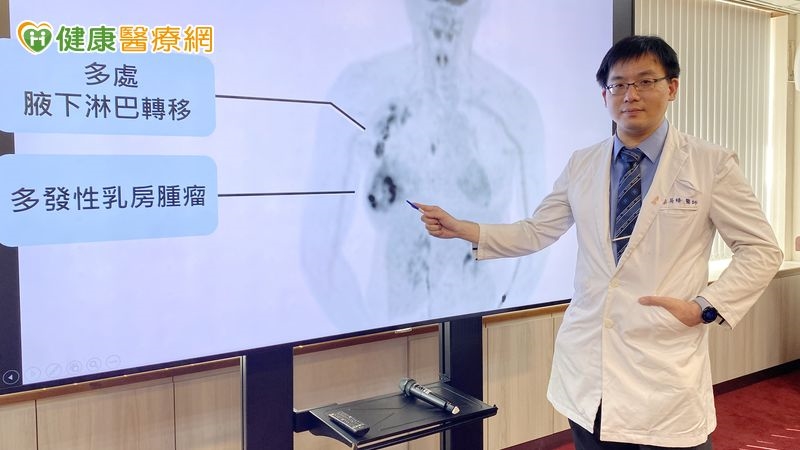 哺乳摸到硬塊別當塞奶！當心三陰性乳癌找上門　解析免疫化療接軌新進展