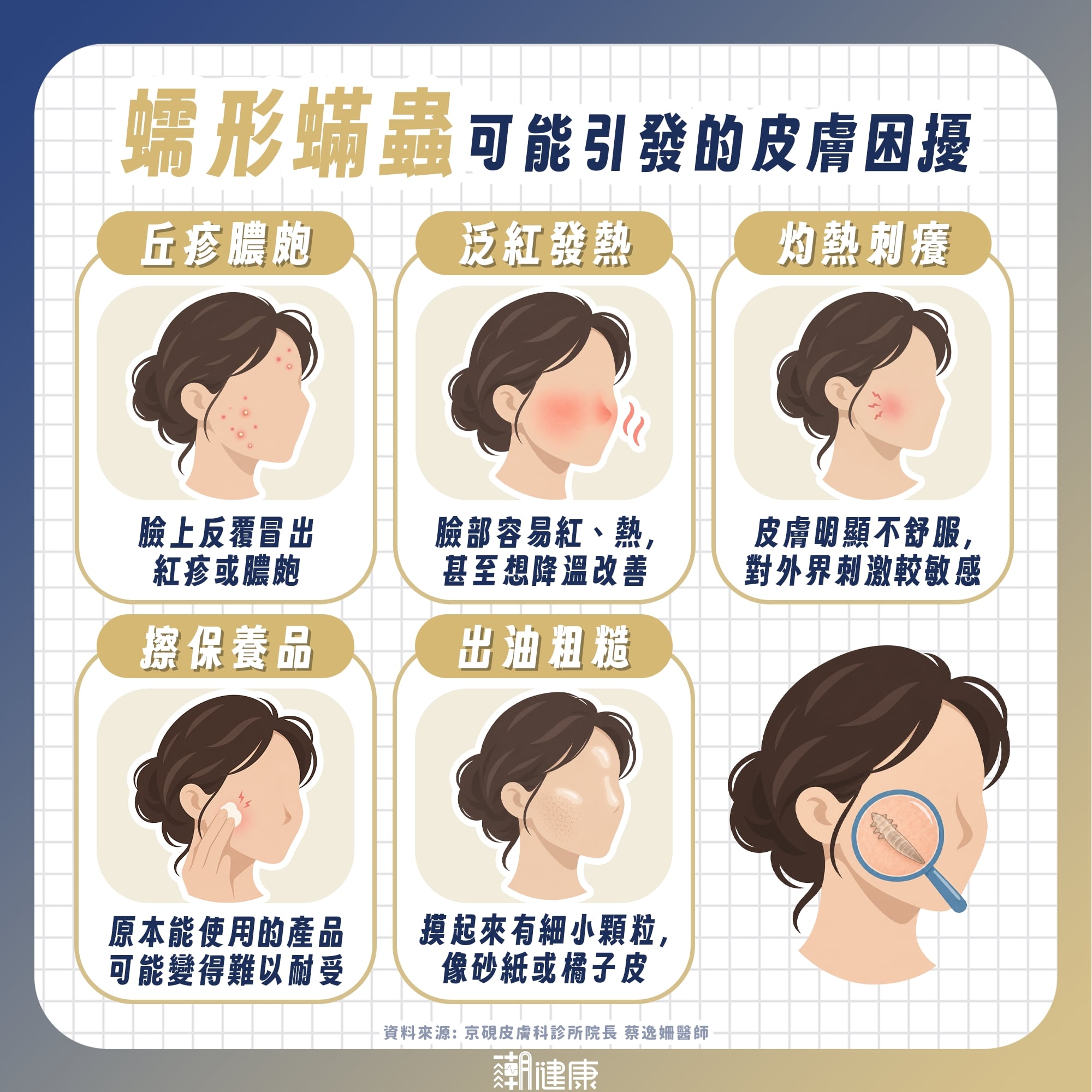 臉上驗出蠕形蟎蟲怎麼辦? 醫揭玫瑰斑治療真相:目標在「改善症狀」而非清零 內文圖片 1