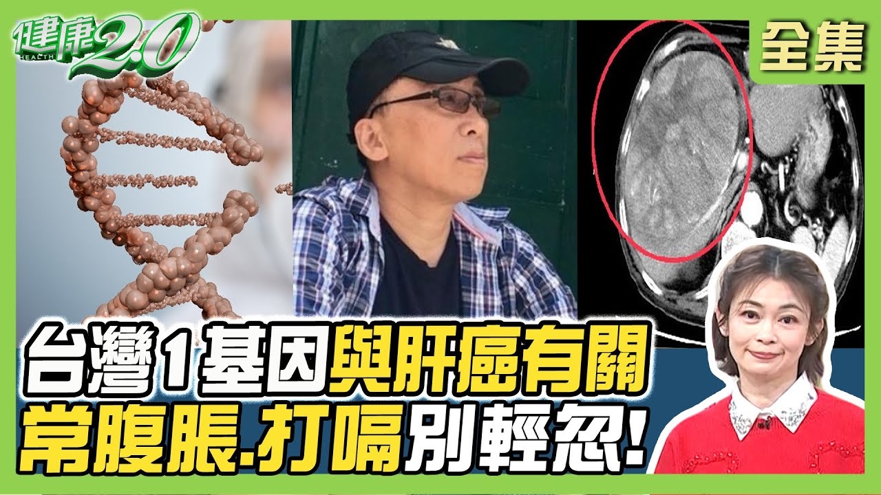 魚夫肝癌病逝 台灣1基因與肝癌有關!肝癌大於5公分 留意這7大症狀!
