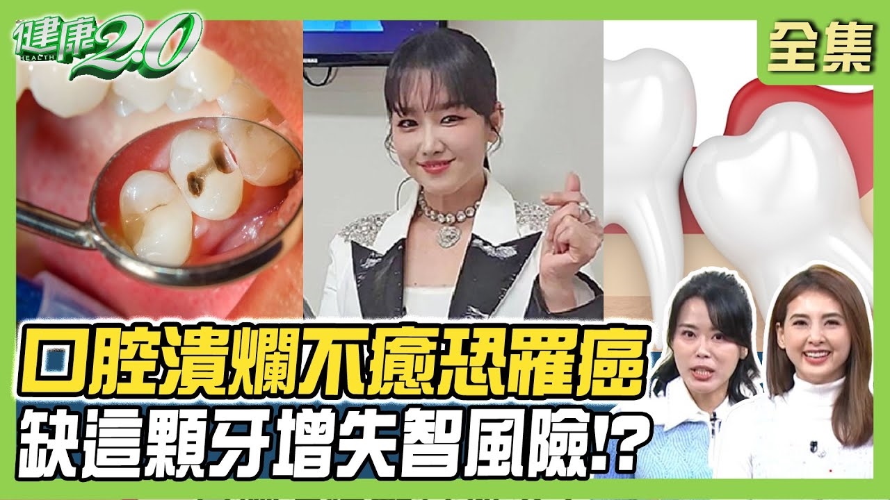 南韓歌手蛀牙割傷舌頭 竟舌癌第三期!周玉琴牙根斷掉 打3針麻藥才拔除!