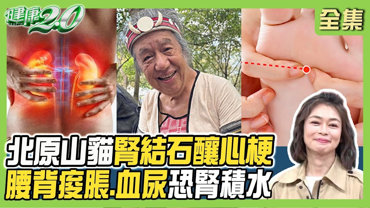 北原山貓昏迷險送命 腎結石成心梗!腎積水2主因 釀腰背痠脹.血尿