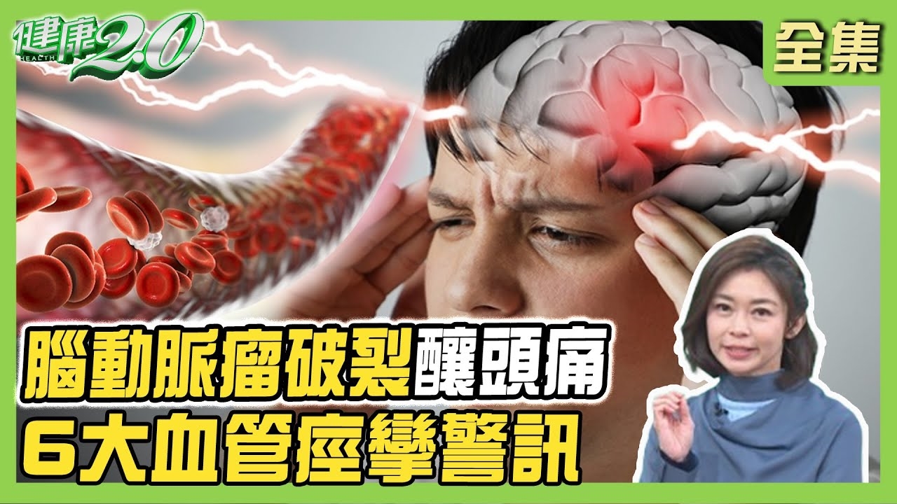 蜘蛛網膜下腔出血原因 ! 腦動脈瘤破裂、外力撞擊 腦動脈瘤是血管壁膨出  結構異常、血流衝擊