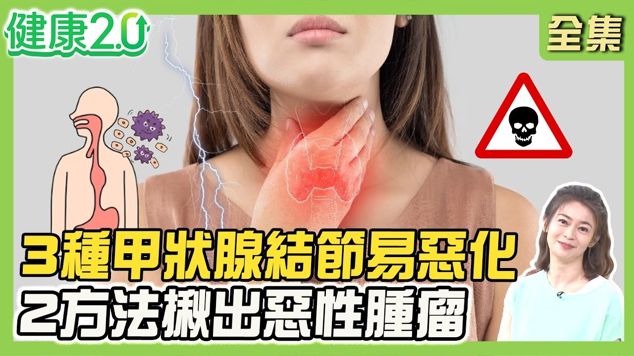 50歲美魔女歌手脖子長3顆 這3種結節惡性化高!超音波+穿刺揪惡性 3手術法切除結節!
