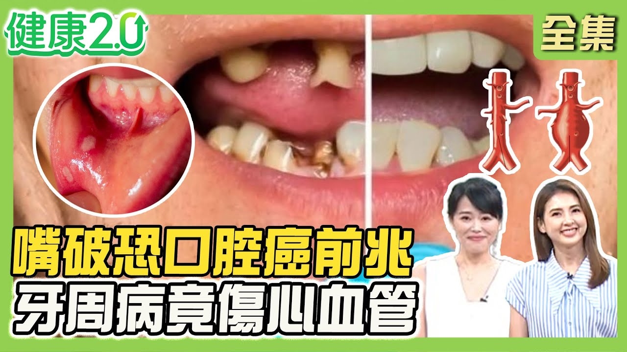 41歲許藍方常暈倒竟罹腦動脈瘤 嘆已寫下遺囑!腦動脈瘤5大常破裂位置 當心壓迫視野缺損.癲癇!