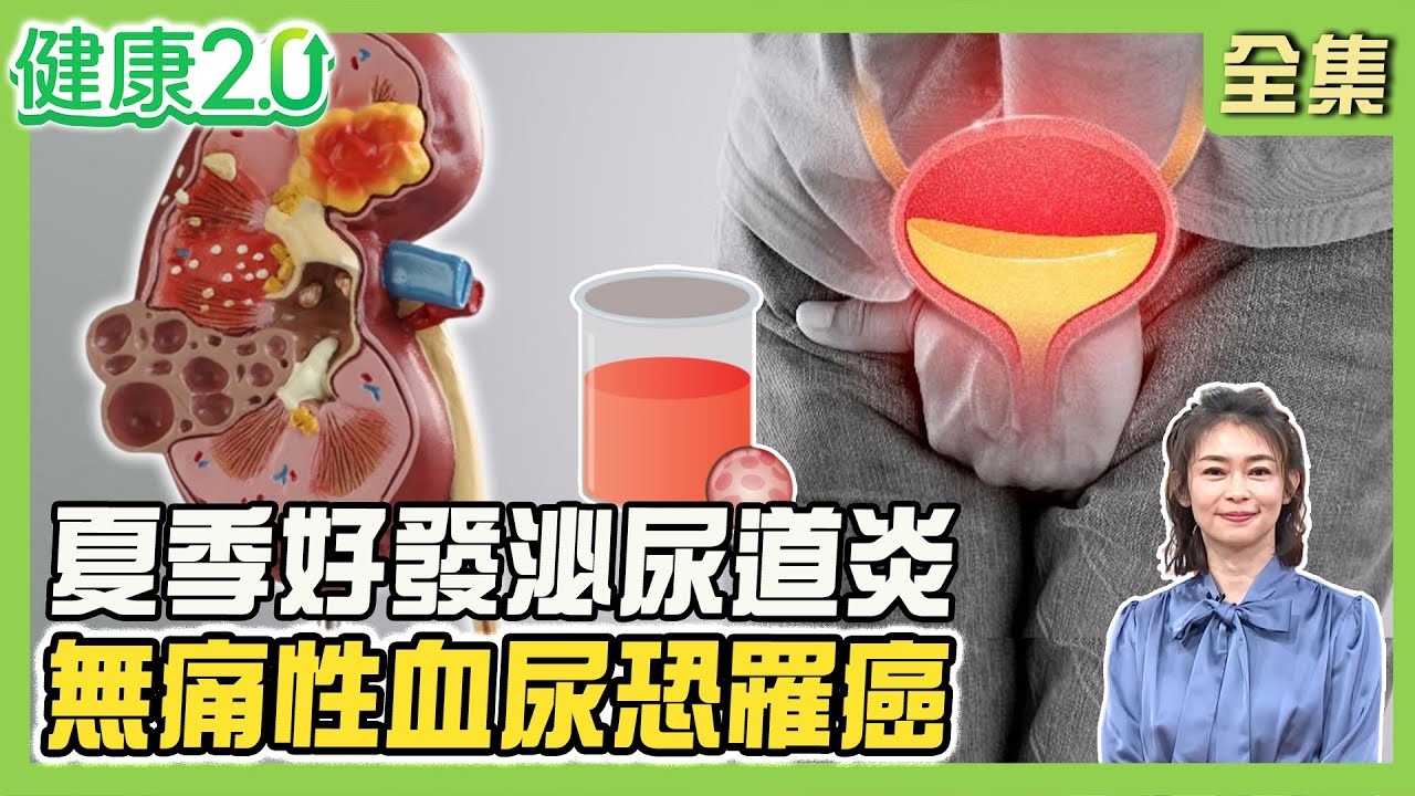 八點檔男星拍戲竟血尿 罹膀胱癌開刀3次!無痛性血尿 當心尿路腫瘤!從血尿形狀 看腎臟.膀胱出血!