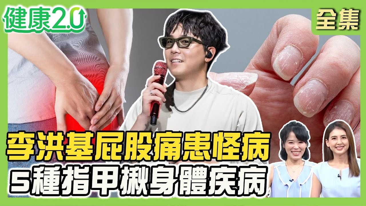 韓星李洪基屁股痛患皮膚怪病!化膿性汗腺炎爆膿漿 汗皰疹常復發治療法!幫身體去濕熱 這道茶消炎症!