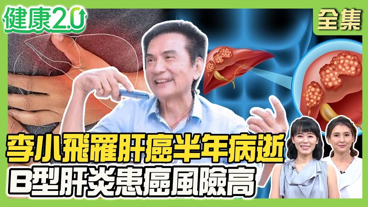 武打傳奇李小飛罹肝癌半年逝 7大併發症凶險!B型肝炎罹肝癌風險高出150倍 2茶飲對症護肝!