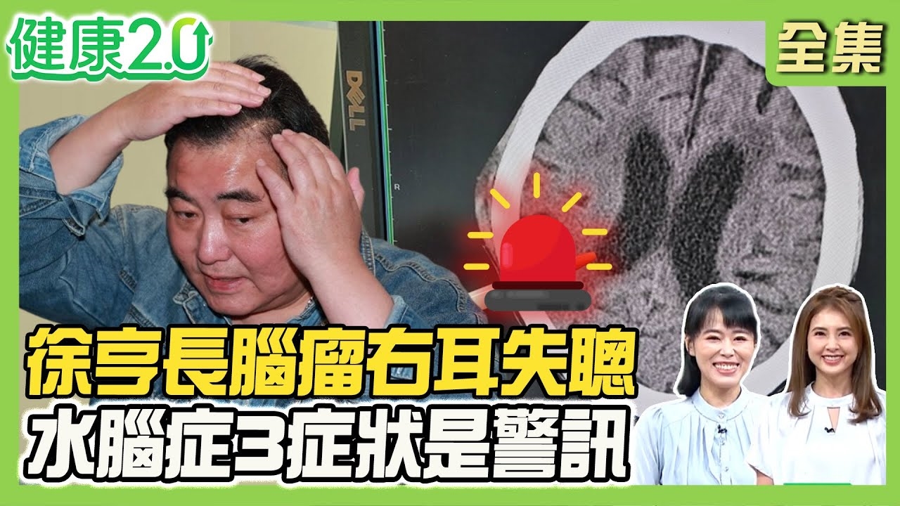 徐亨暴肥長腦瘤右耳失聰 水腦症易誤認為失智!水腦症3大症狀 走路有如被磁鐵吸住!巴金森病撲克臉.手抖
