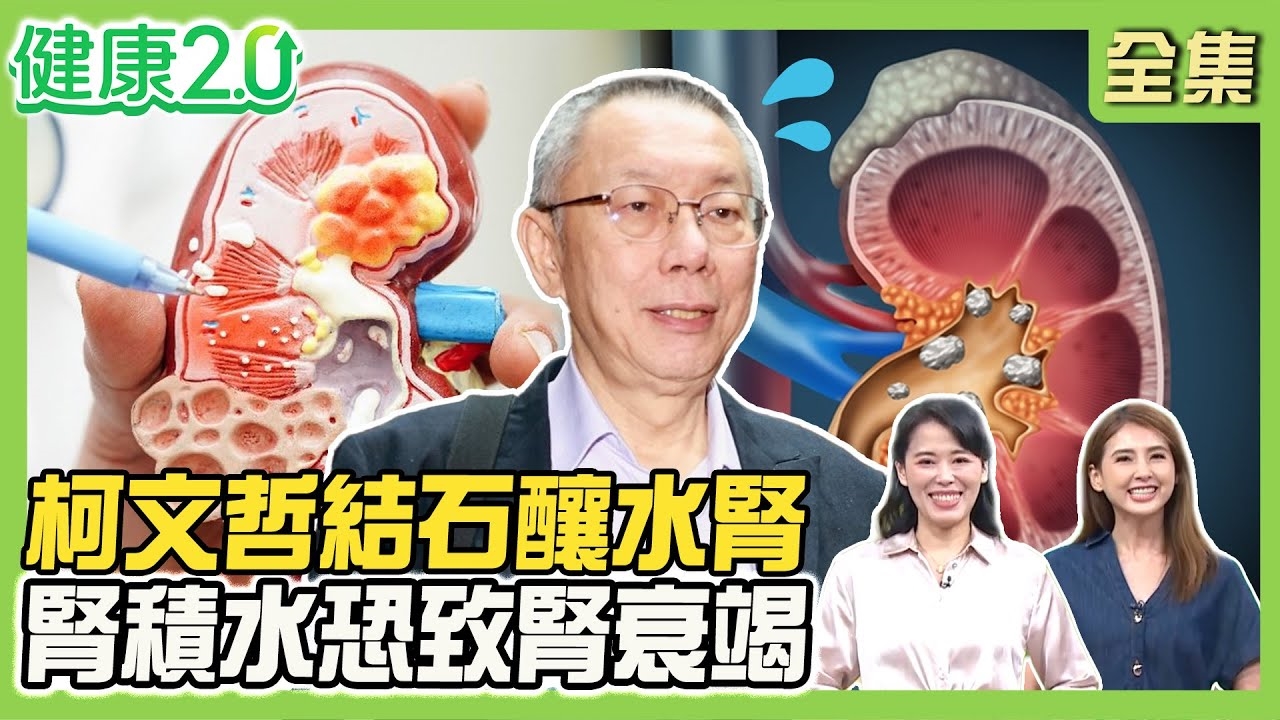 柯文哲腰痛水腎.輸尿管結石!結石卡4部位症狀不同 腎積水恐致腎衰竭!狂喝可樂養出35顆結石