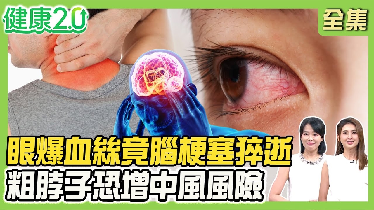 33%有頸動脈斑塊 視線模糊小心腦梗致命！日本男星左眼爆血絲竟腦梗塞2天猝逝！粗脖子中風風險高3倍！