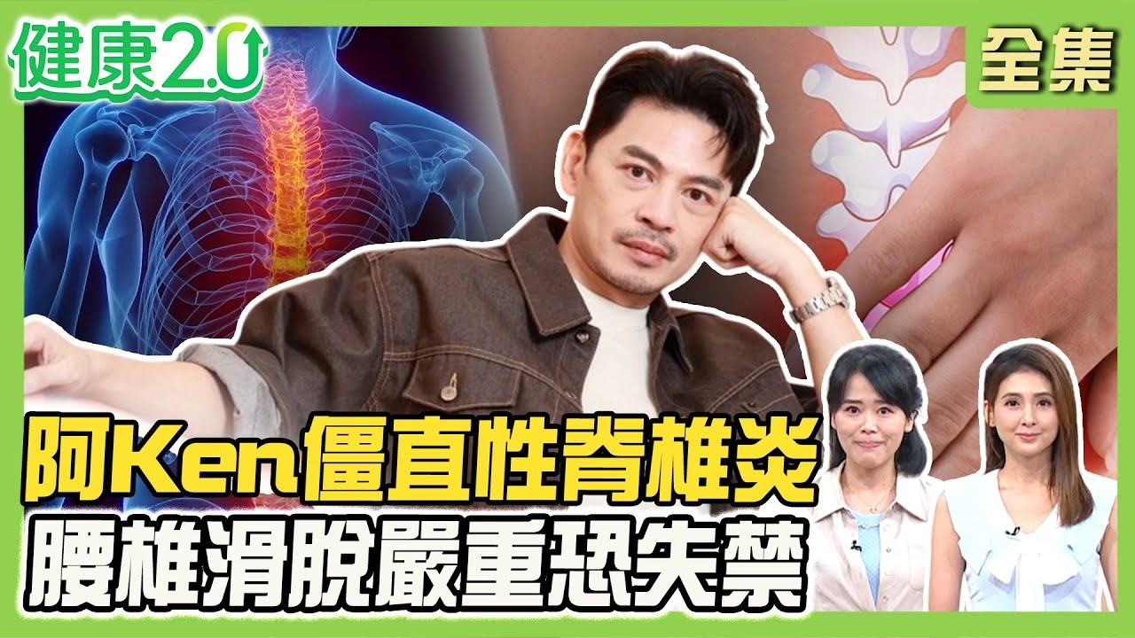 從痛點位置看腰痛警訊!阿Ken背痛.晨間僵硬 確診僵直性脊椎炎!女性僵直性脊椎炎誤診率高 4招改善