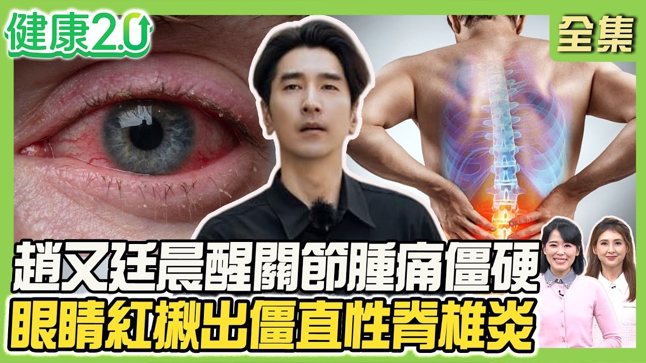 趙又廷罹類風濕關節炎 晨醒關節腫痛僵硬!正陽上玄功通氣血 +手浴方消炎促血循!女星乾癬全身冒紅斑