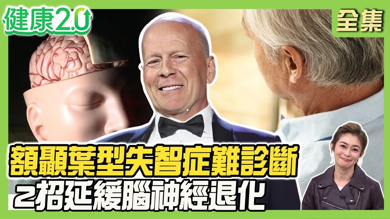 布魯斯威利身後捐腦做研究!額顳葉型失智症 中壯年失智主因!15%失智者臨床診斷與病理解剖不一致!