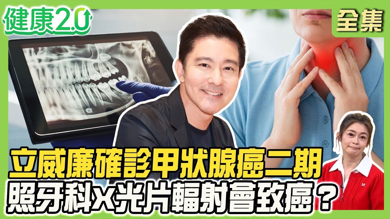 立威廉確診甲狀腺癌二期!甲狀腺癌初期無症狀 2招揪出癌變!照牙科X光會致癌?甲狀腺手術難纏 損傷神經
