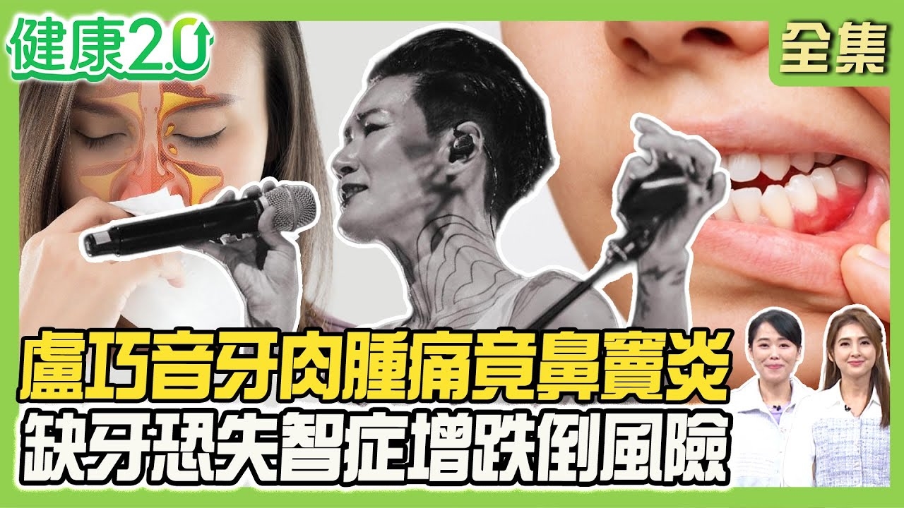 盧巧音牙肉腫痛2個月竟鼻竇炎!假牙一脫老20歲!缺牙恐失智症增跌到風險!冬天幫嘴破潰瘍滅火祕訣!