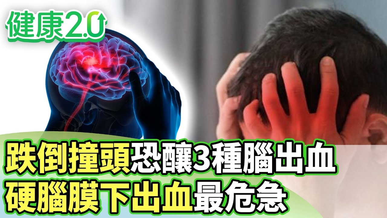 王月跌倒摔破頭 開顱搶救昏迷5天!跌倒撞頭恐釀3種腦出血!肌少症增跌倒骨折風險7倍!天冷易閃到腰