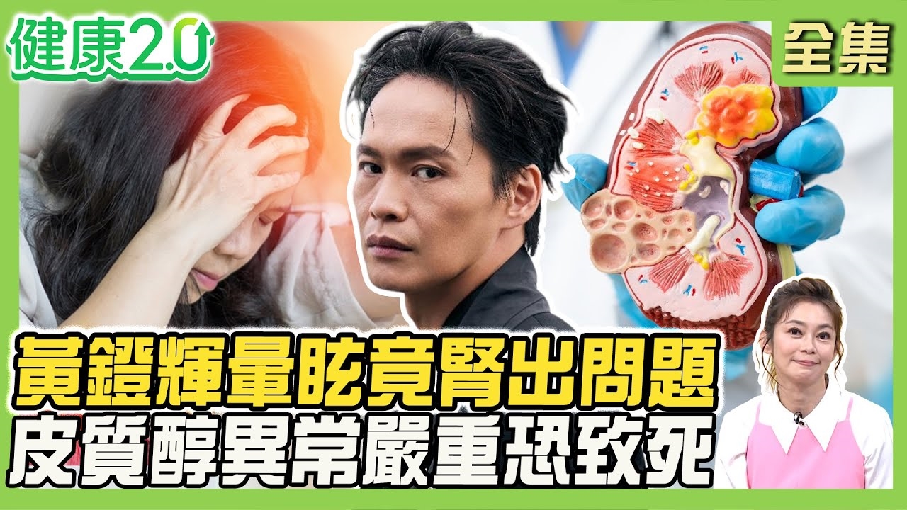 黃鐙輝常暈眩竟腎出問題 皮質醇異常恐致死!年輕高血壓族群2成腎上腺異常!注意12種內分泌症狀!