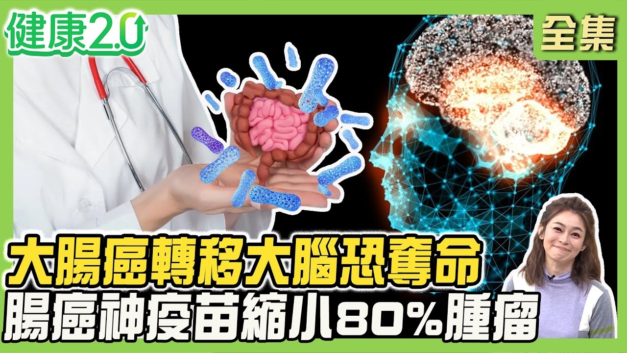 大腸癌雙效疫苗 成功縮小80%腫瘤!5腸道警訊易被忽略!腸癌轉移3路徑 最怕轉移大腦奪命!4營養素
