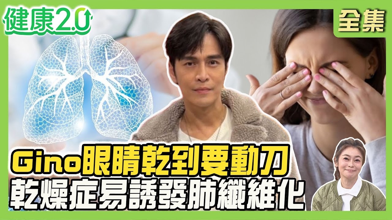 Gino眼睛乾到要動刀!乾燥症侵襲眼、皮膚易引肺纖維化!冬季皮膚癢不停 判別3關鍵!乾癬患者心梗致命