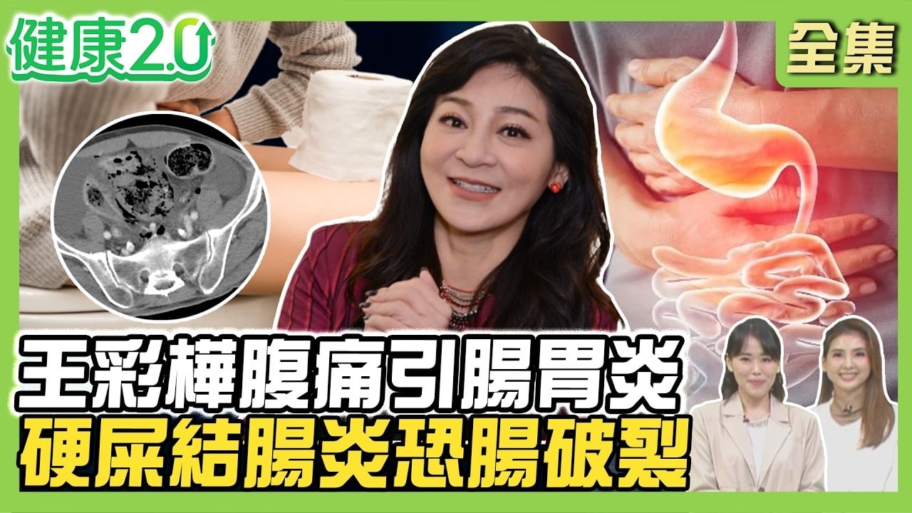 王彩樺過年腹痛引腸胃炎!5大常見腸胃疾病!天冷硬屎糞性結腸炎恐腸破裂 腸道按摩這樣做!