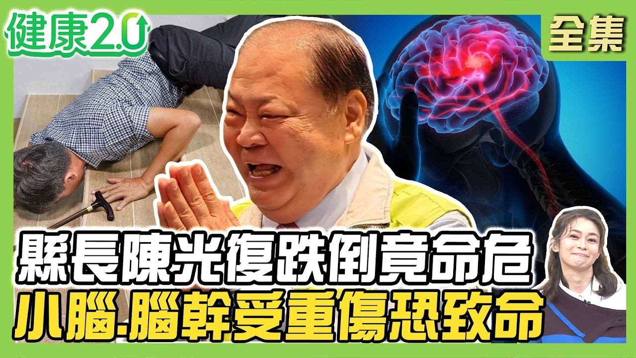 澎湖縣長陳光復跌倒竟OHCA命危!後腦重創傷及小腦、腦幹恐致命!白內障導致對比下降增跌倒風險!